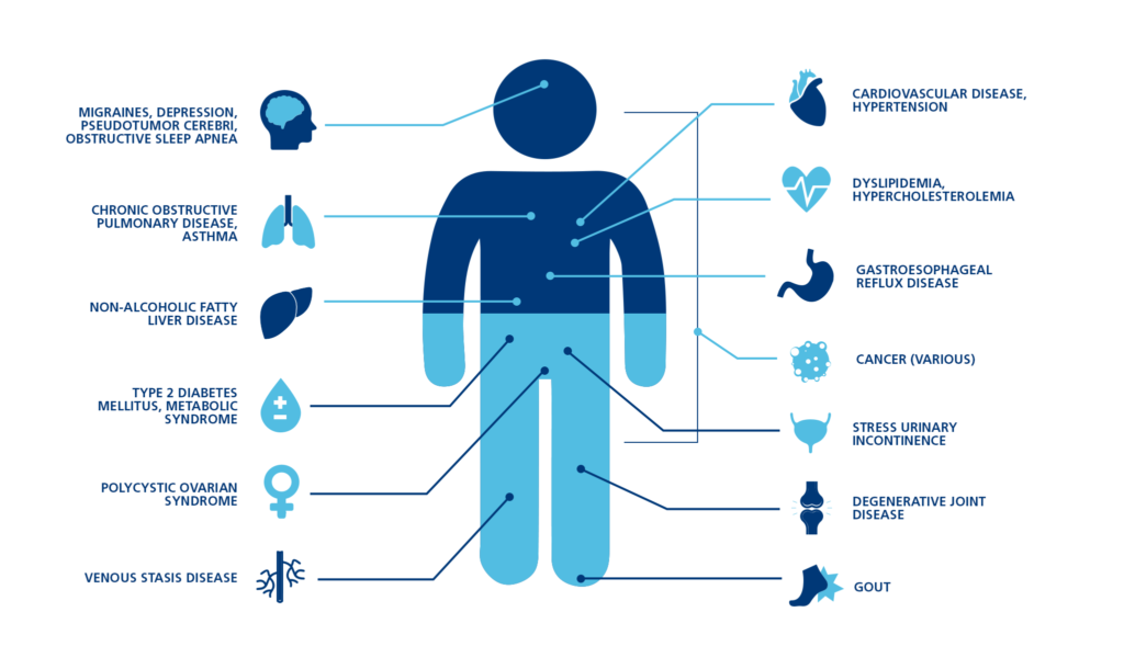 Obesity Comorbidities